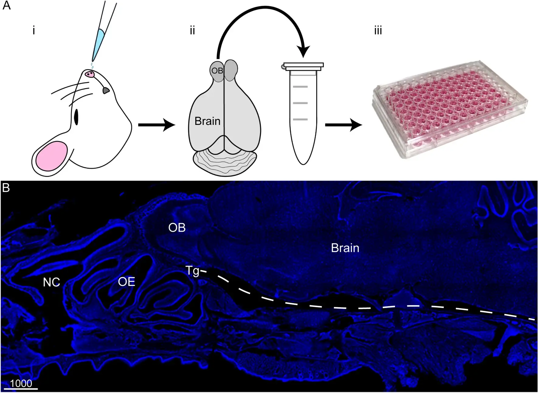 Bacteria Linked to Alzheimer's Sneak Into Brain Through Smell and Touch Nerves